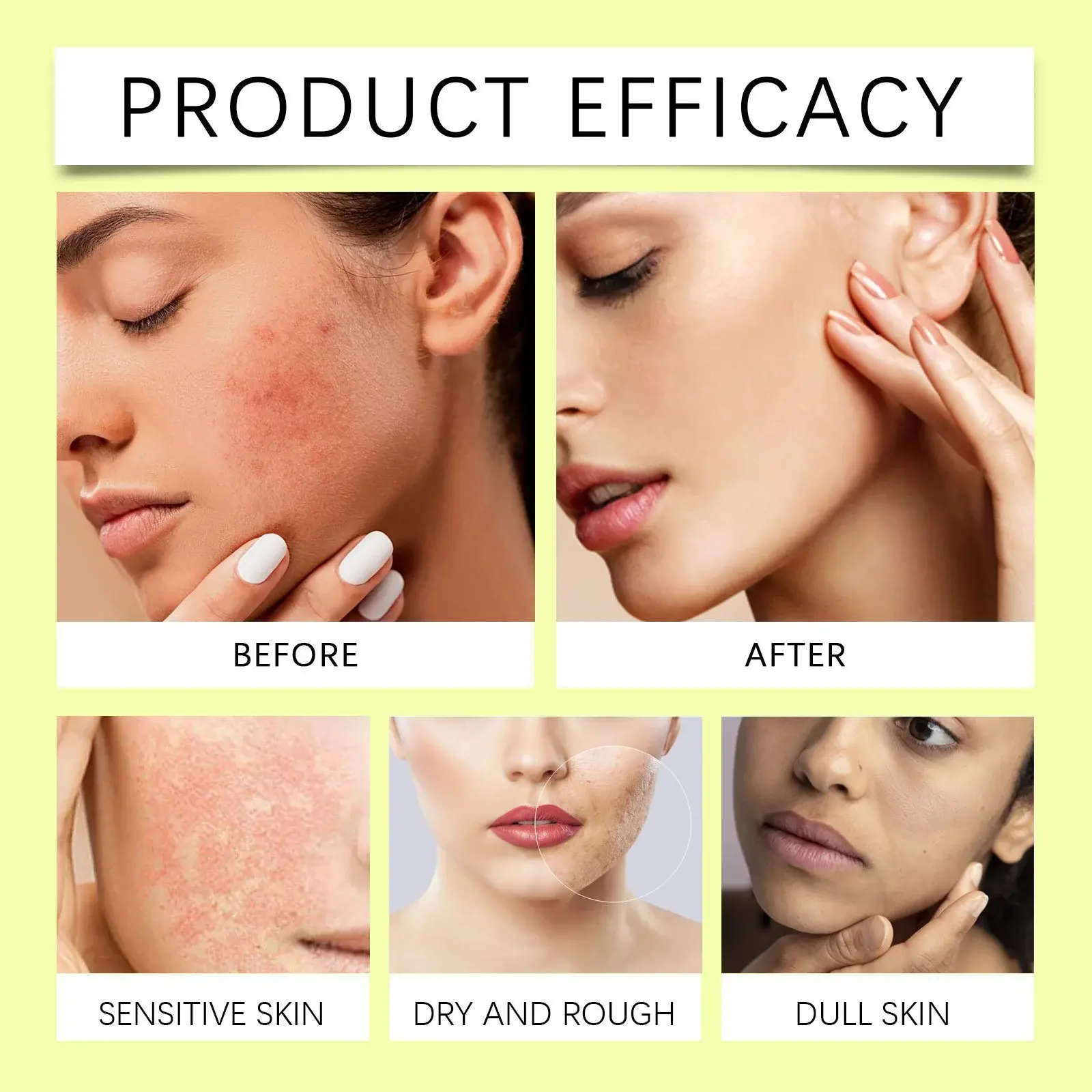 Centella Hydrating Gel for Soothing and Moisturizing - Hoygi 9 HO A05 0339 01 010