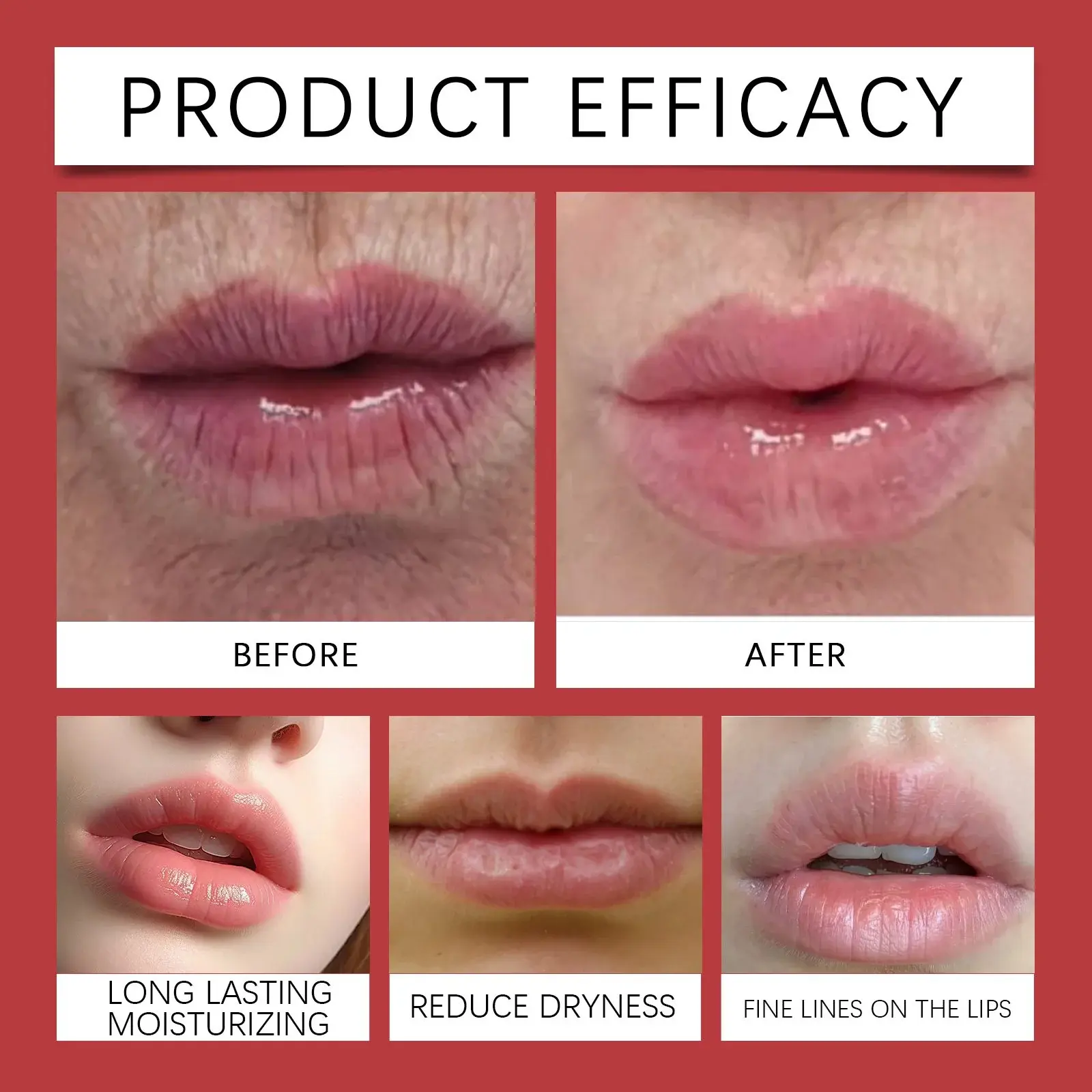 Lip Repair Cream for Fine Lines and Smile Lines by Hoygi 9 HO A05 0469 01 1727173842008