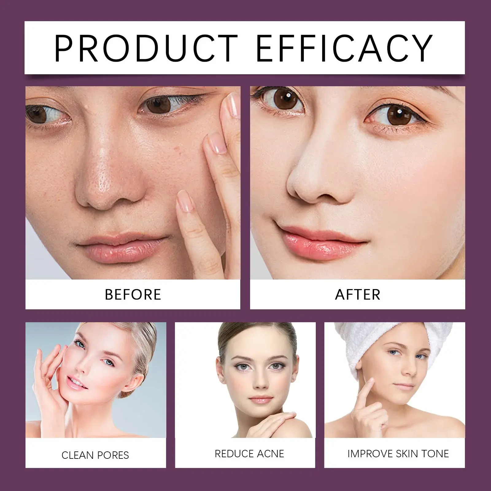 Blackhead Brightening Mask - Hydrating & Pore Cleansing Formula 10 HO A05 0532 01 1729940430021