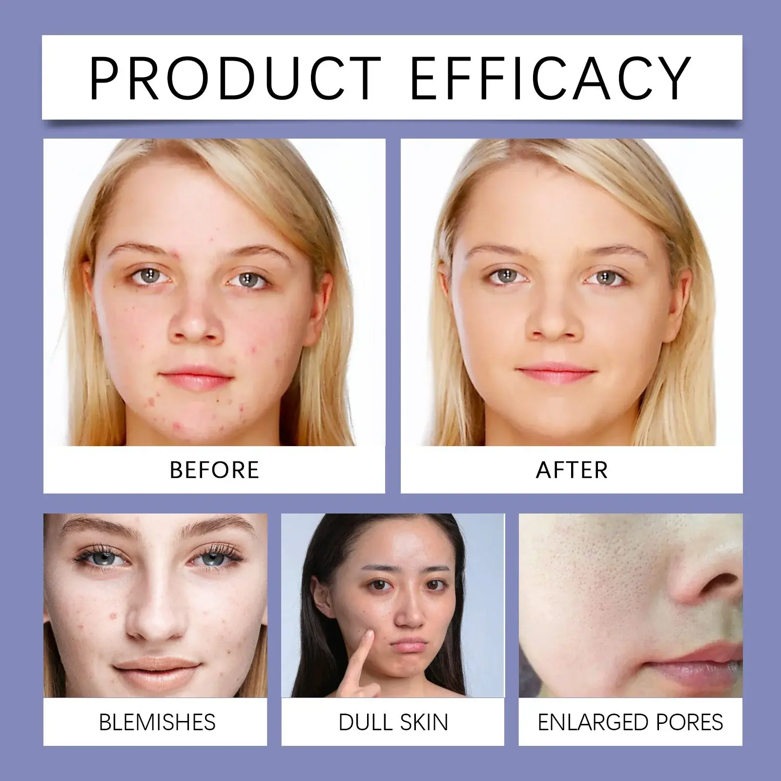 Acne Cleanser Moisturizing Face Wash with Hyaluronic Acid & Collagen - Hoygi 9 HO A05 0578 01 1731375052021