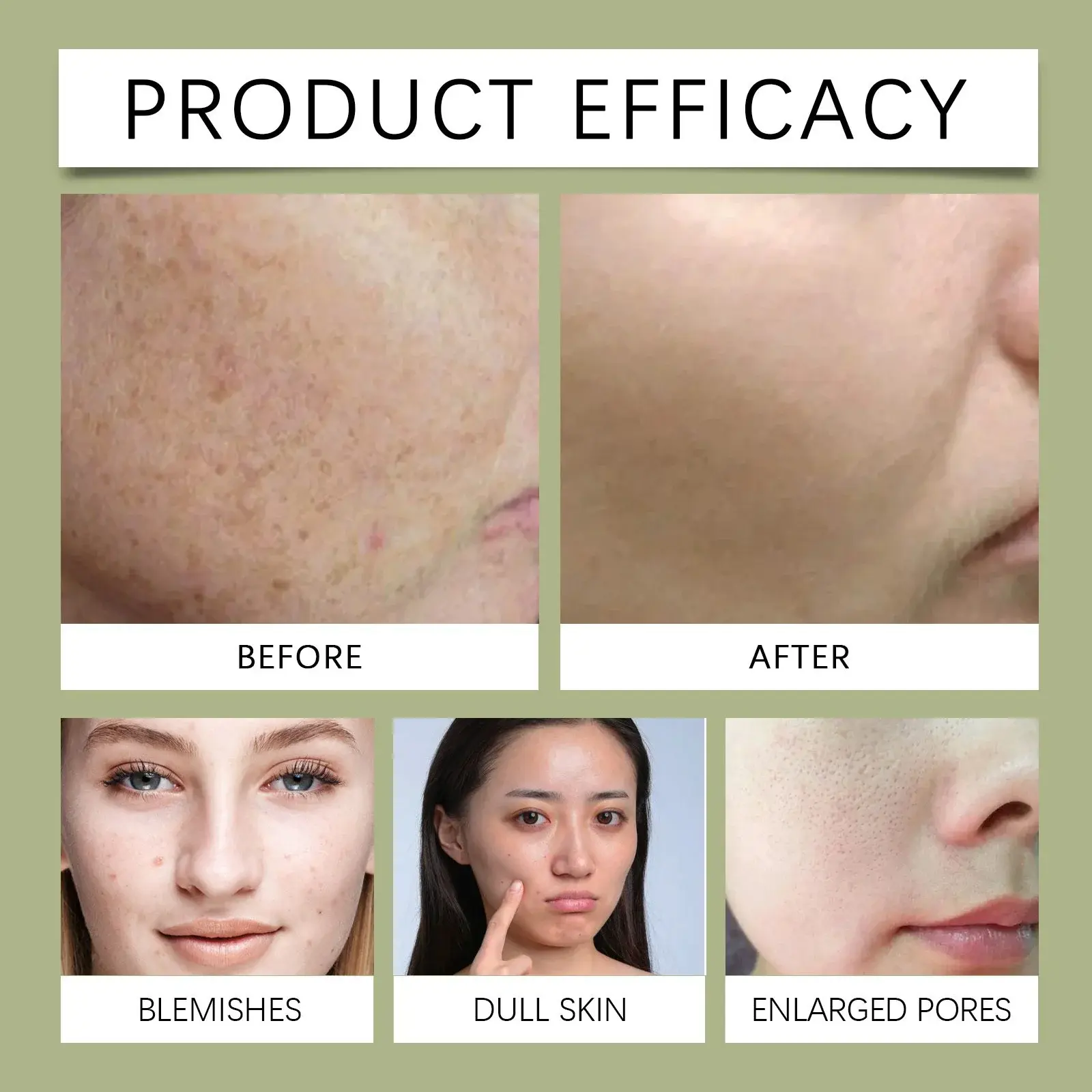 Avocado Cleansing Bubble Mask - Hydrating & Pore Refining - Hoygi 9 HO A05 0584 01 1731569444021