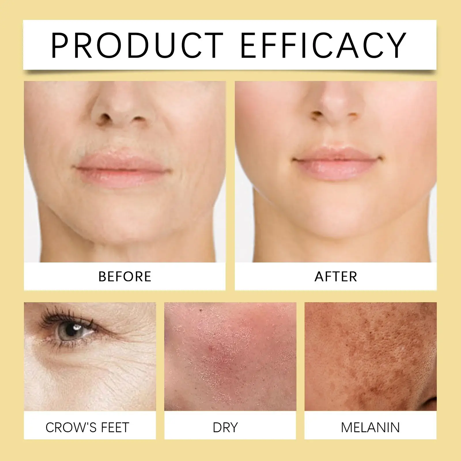 Bee Venom Face Firming Cream Nourishing & Moisturizing - Hoygi 9 HO A05 0648 01 1733536909019
