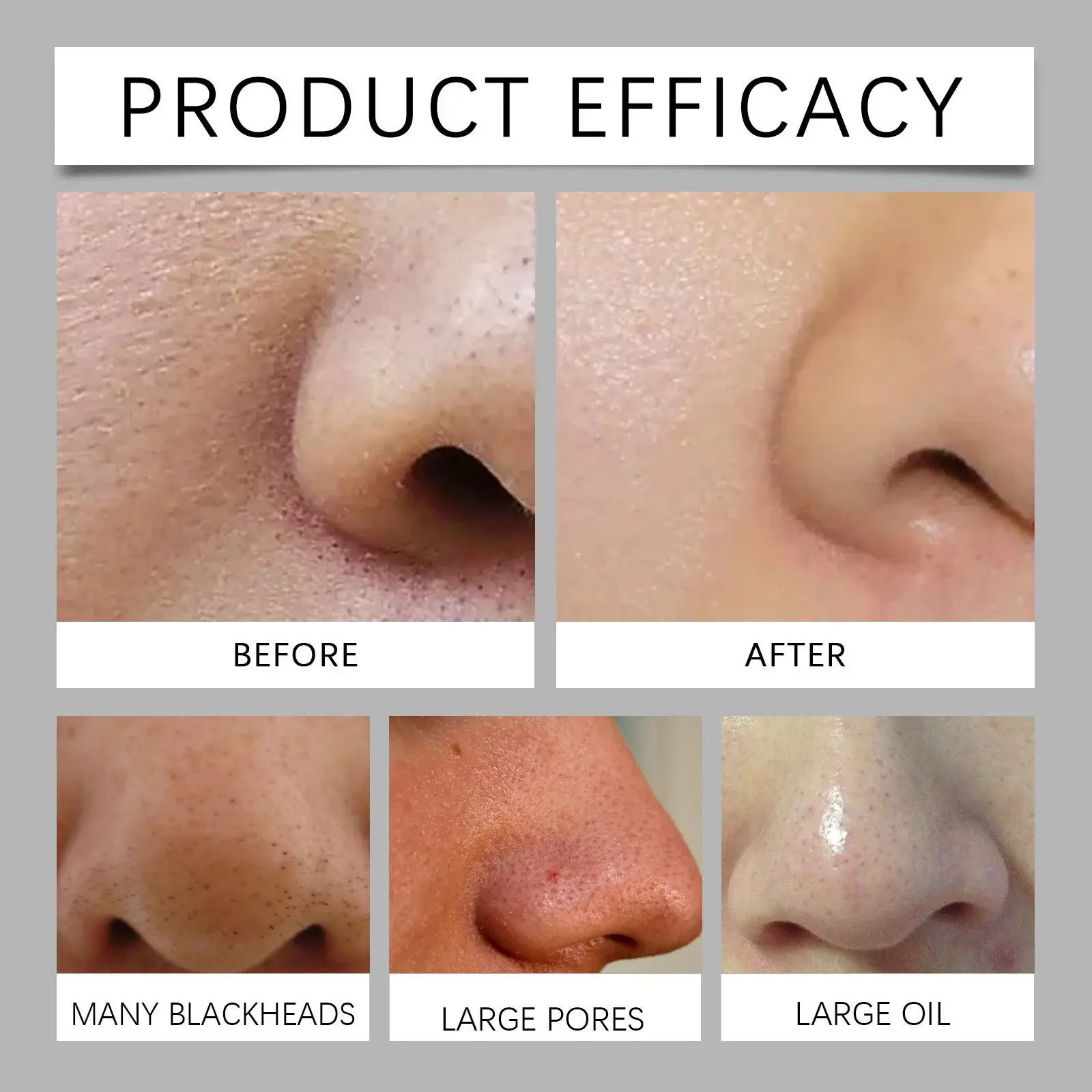 Blackhead Nose Mask Set - Gentle Pore Cleansing & Moisturizing Formula 10 HO A05 0715 01 72119272