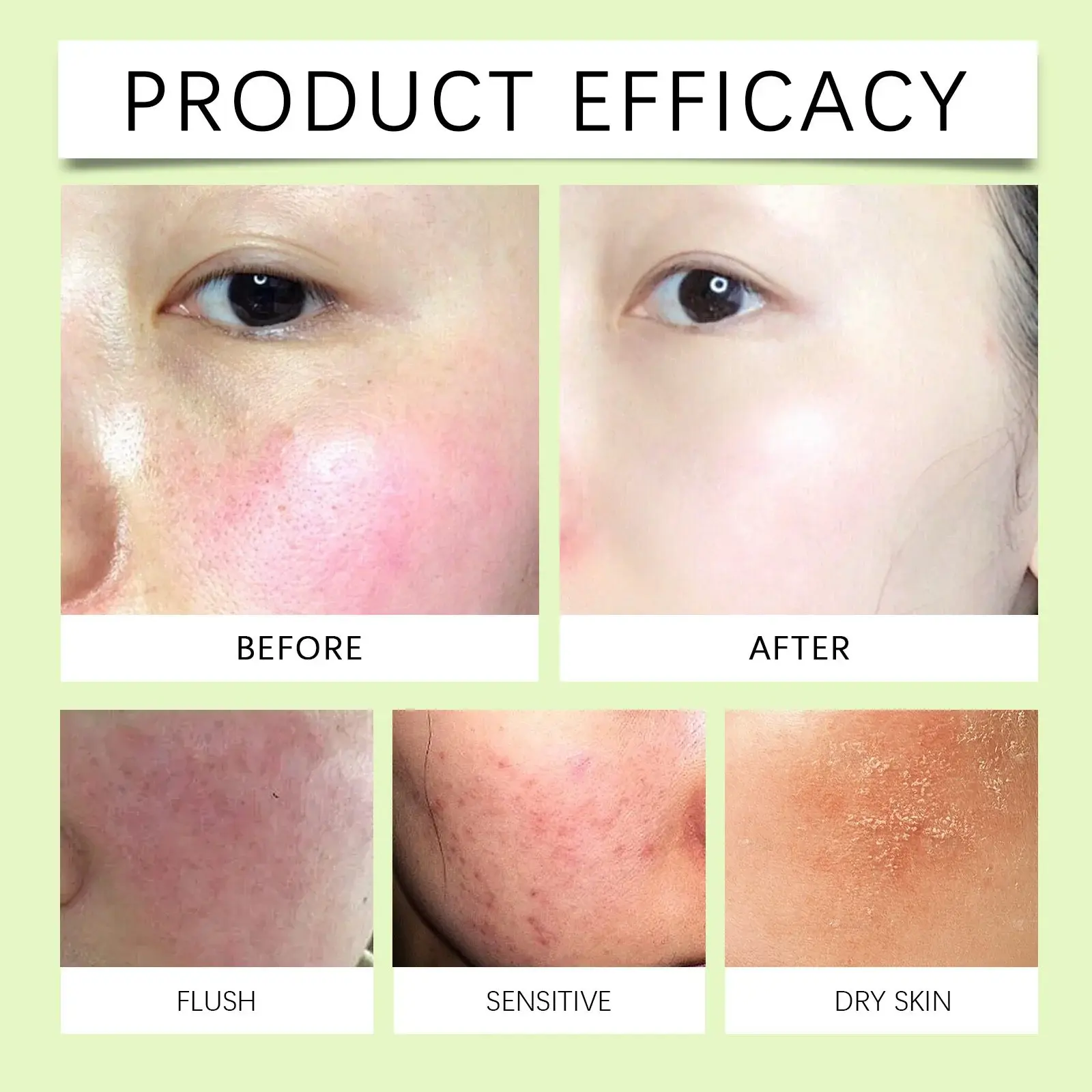 Centella Moisturizing Gel for Facial Skin - Hydrating & Soothing Formula 12 HO A05 0733 01 87796977