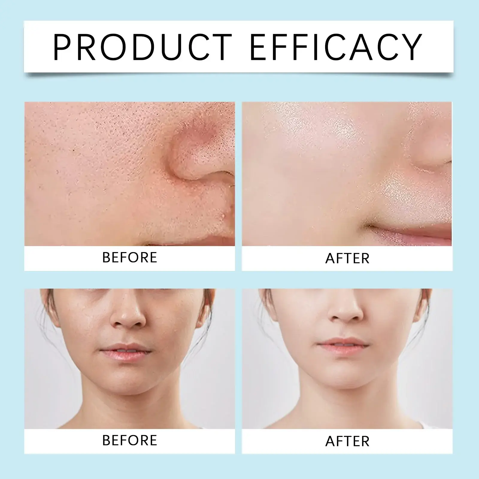 Exfoliating Oil-Control Toner with Salicylic Acid & Centella - Hoygi 10 HO A05 0734 03 90461662