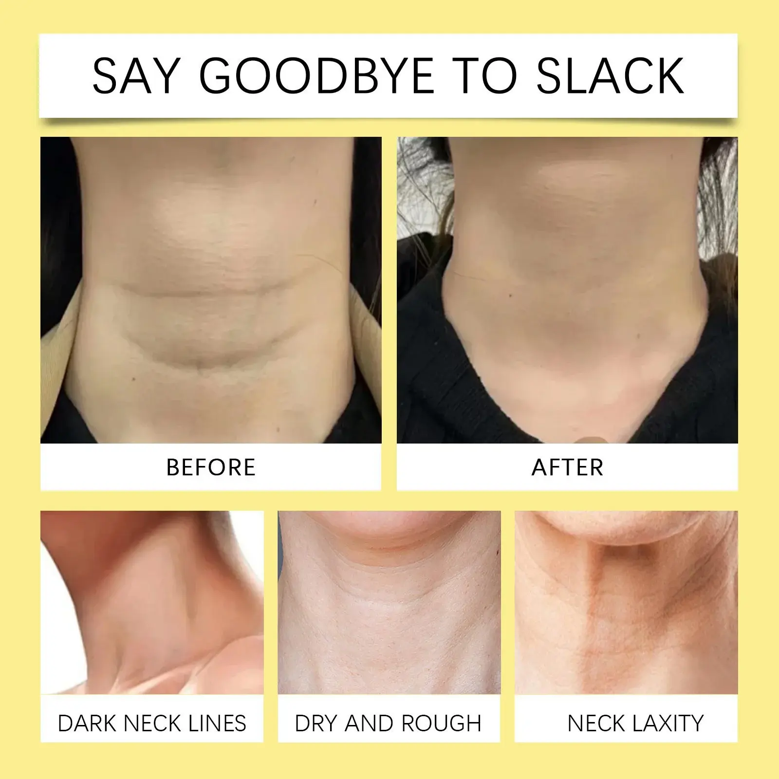 Retinol Neck Cream - Hydrating & Skin Tightening Formula 12 HO A05 0751 01 57028361