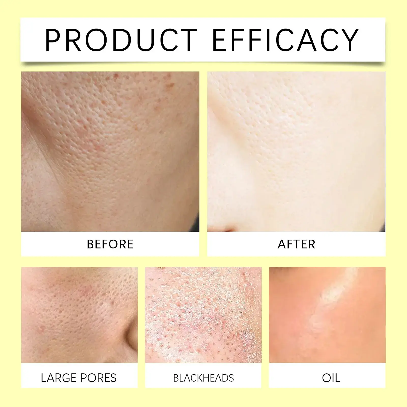 Turmeric Acid Cleansing Pads for Pore Refining & Skin Brightening 9 HO A05 0765 01 60273622