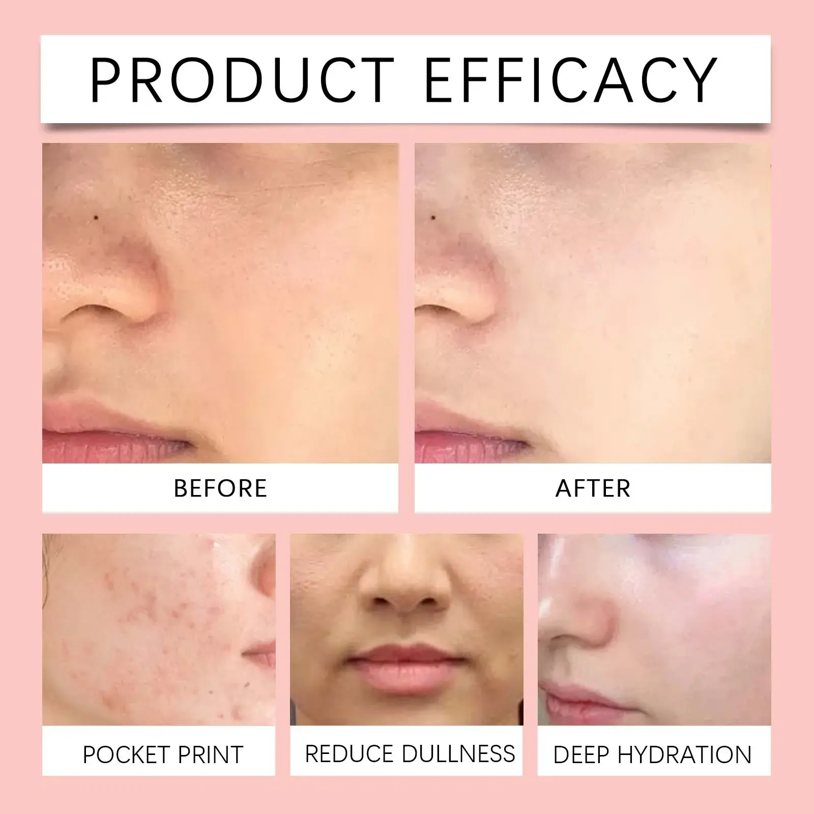 Nicotinamide Rose Moisturizing Facial Spray - Hydrating Daily Mist 12 HO A05 0790 01 48041692
