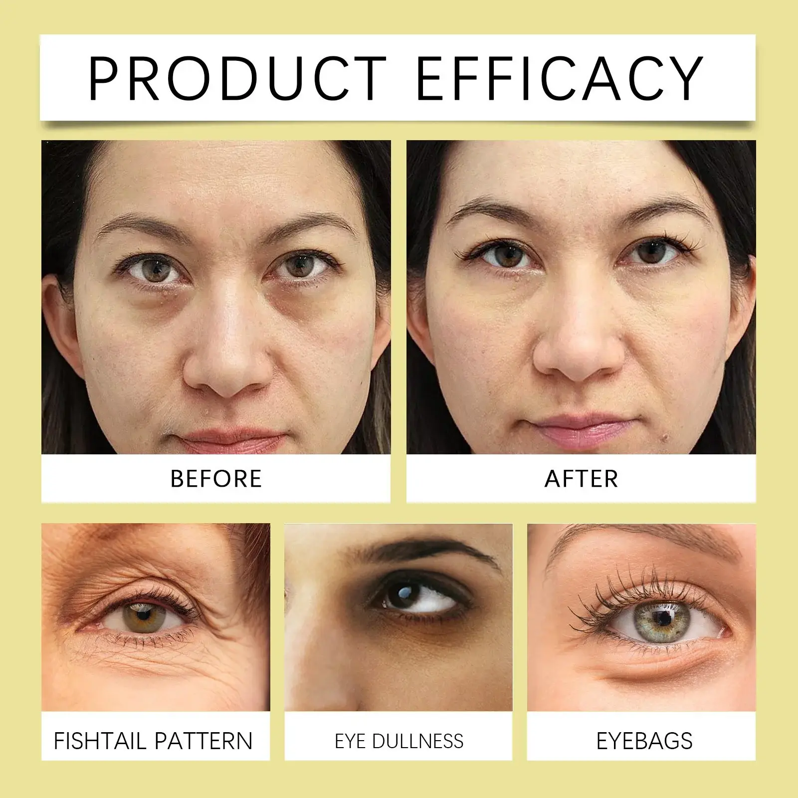 Eye Care Gel for Dark Circles and Nourishment - Hoygi 9 HO A05 0806 01 89282053
