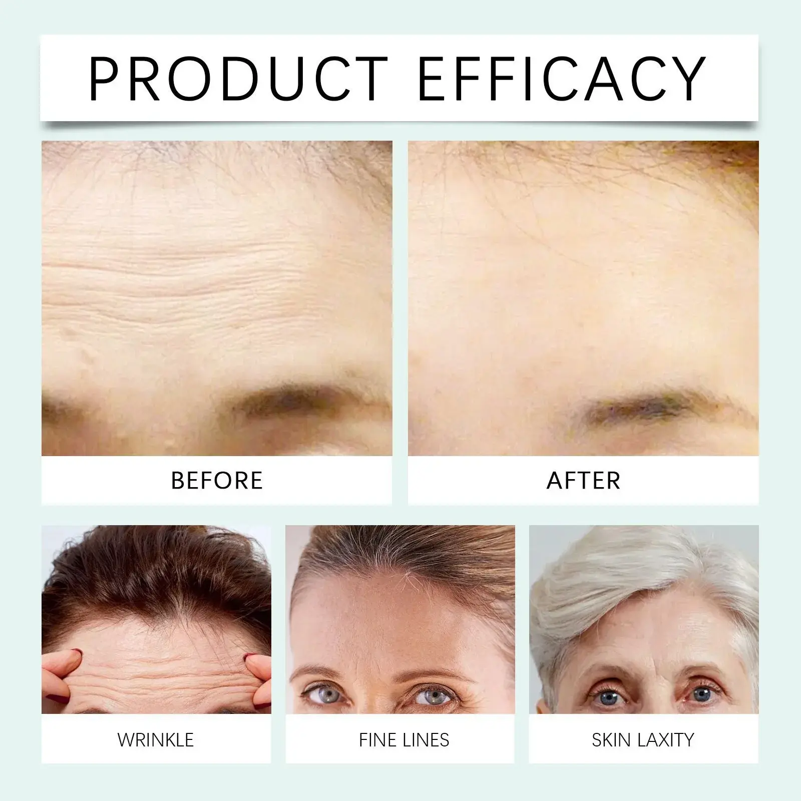Aloe Vera Forehead Firming Patches for Hydrating & Firming - Hoygi 12 HO A05 0819 02 61277117