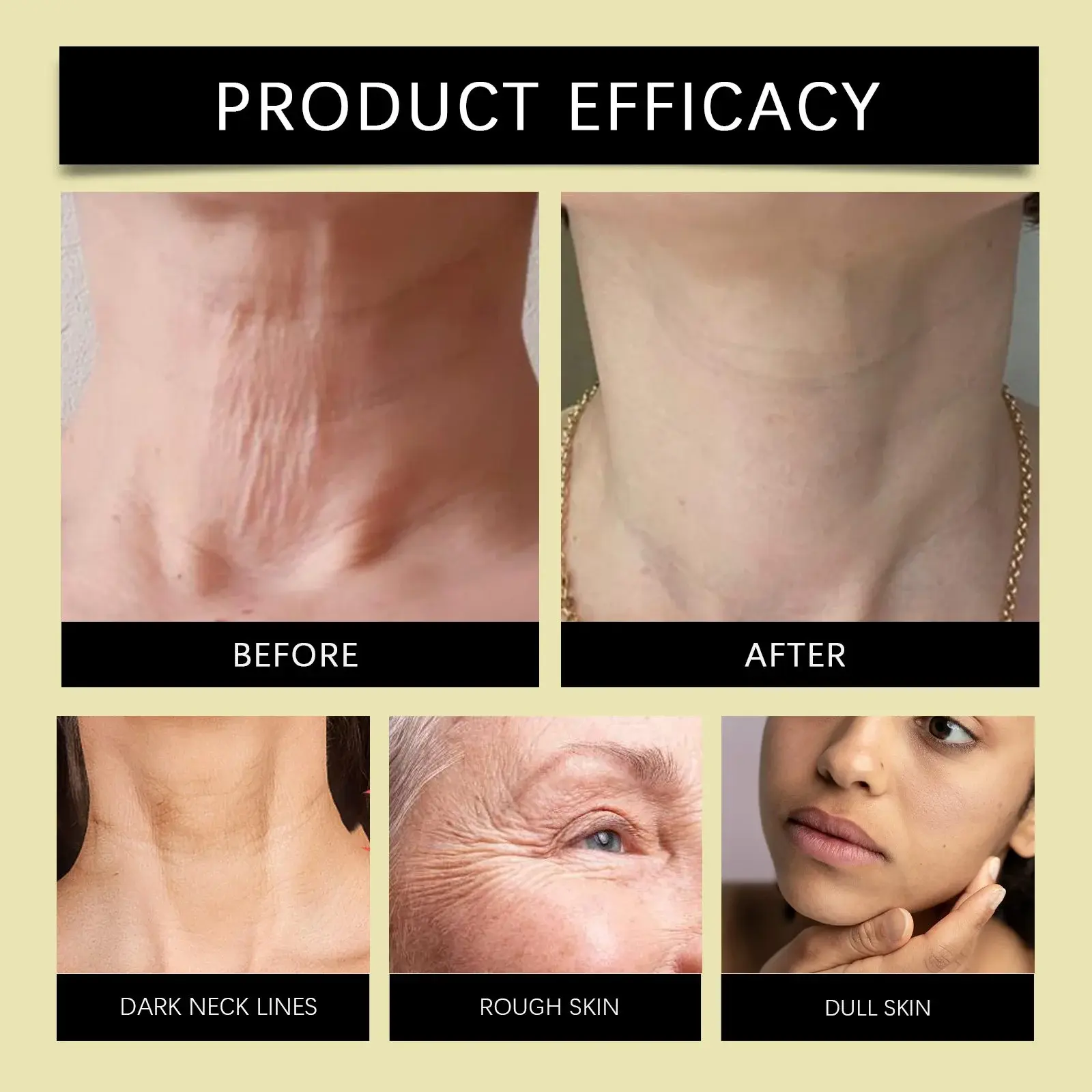 Bee Venom Neck & Face Stick: Firming & Hydrating Formula - Hoygi 9 HO A05 0912 01 97644610