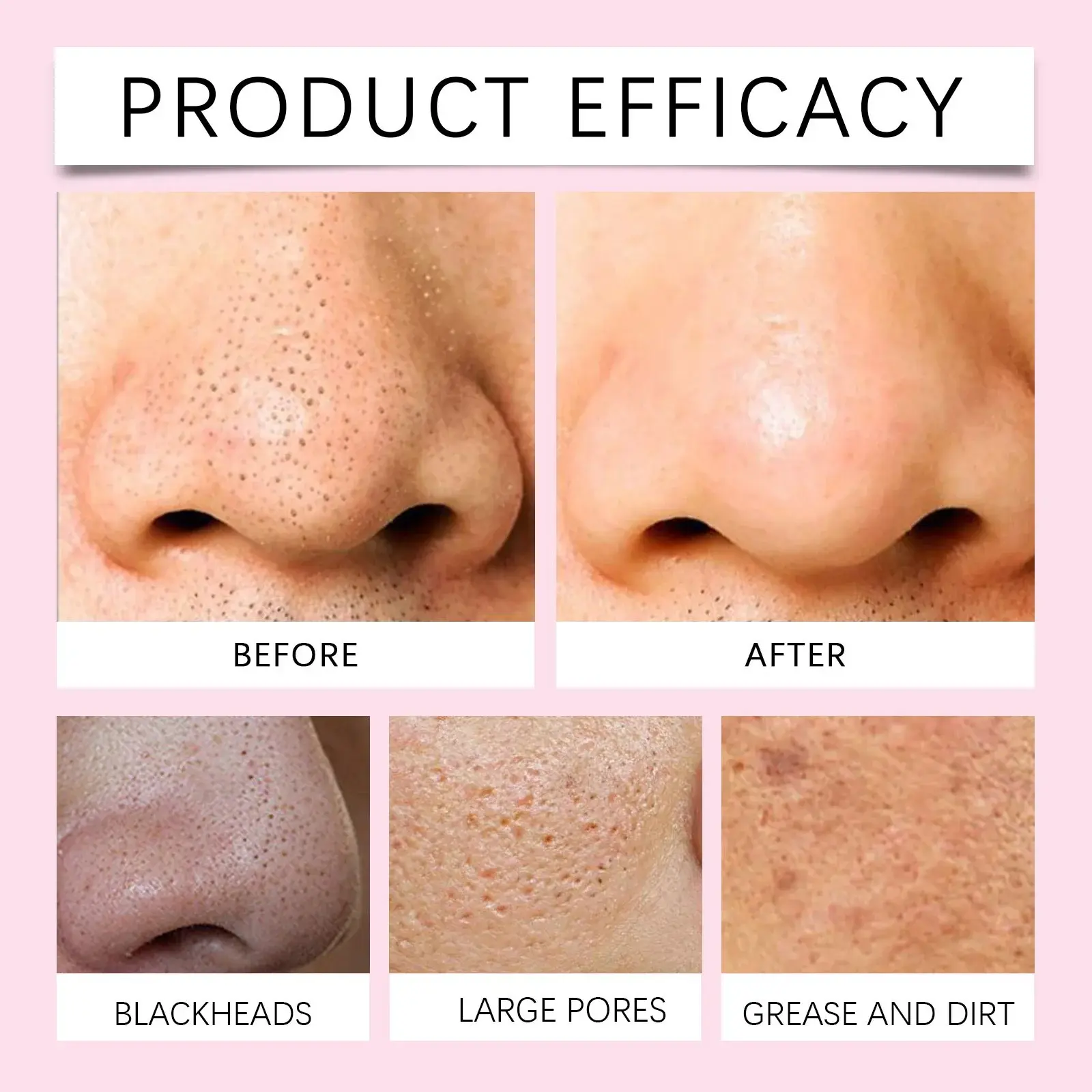 Nicotinamide Deep Facial Cleanser for Acne-Prone Skin - Hoygi 12 HO A05 0964 03 95501835