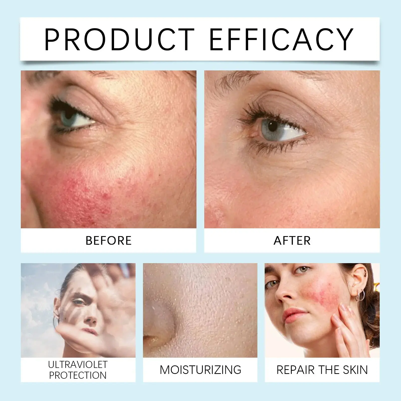 Moisturizing Protective Cream with Hyaluronic Acid - Hoygi 10 HO A05 0975 01 78584880