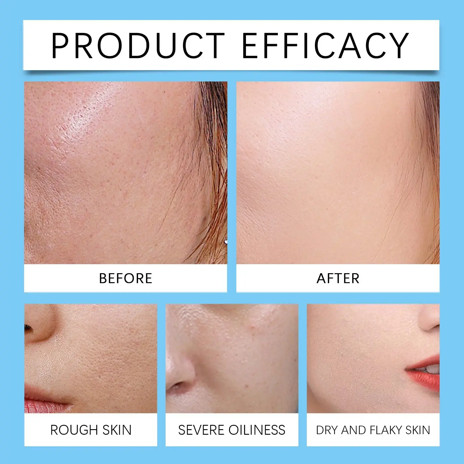 Hyaluronic Acid Brightening Essence for Radiant Skin - Hoygi 9 HO A05 0984 01 70560133