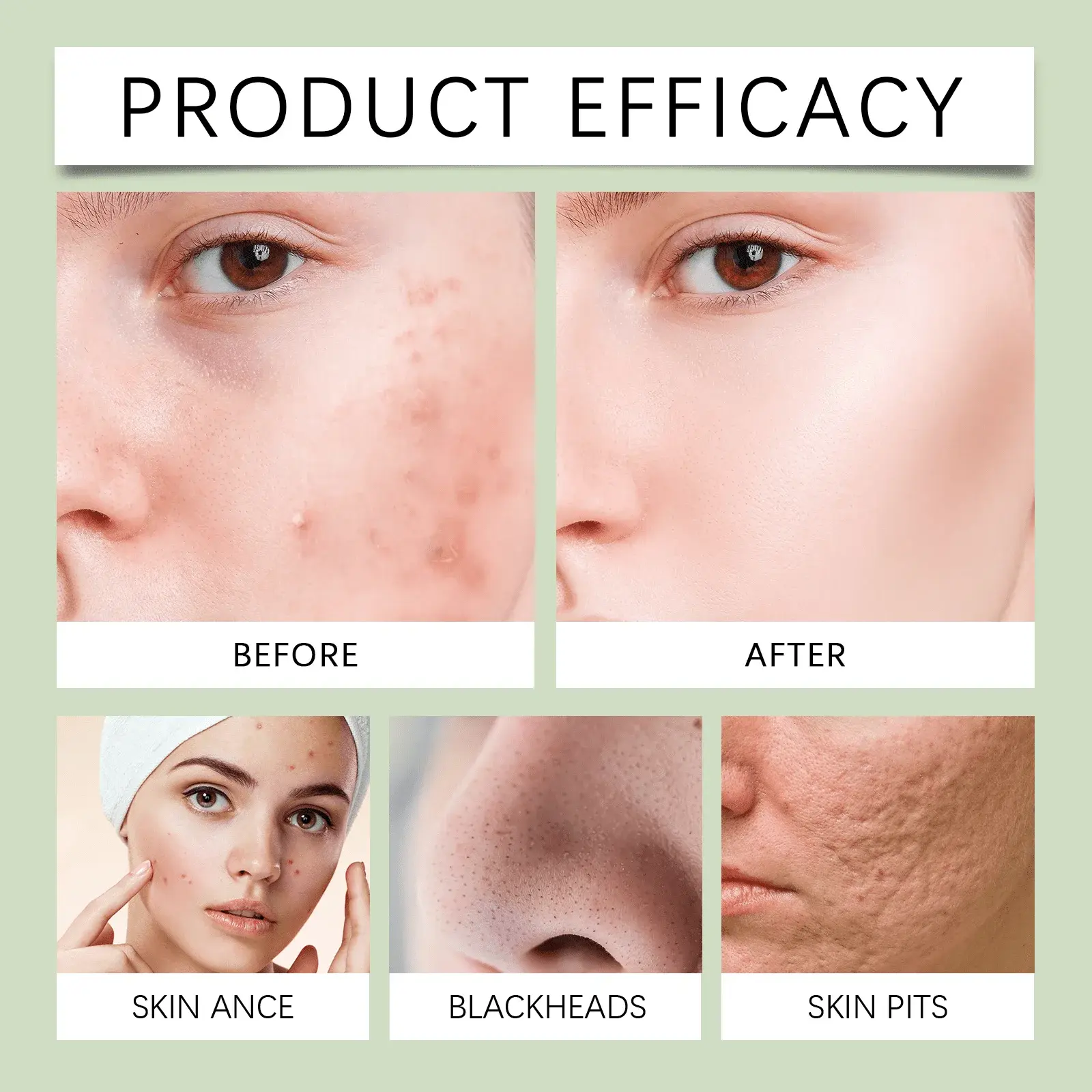 Green Tea Salicylic Acid Facial Cleanser for Gentle Pore Cleansing - Hoygi 12 HO A05 0999 01 11338943