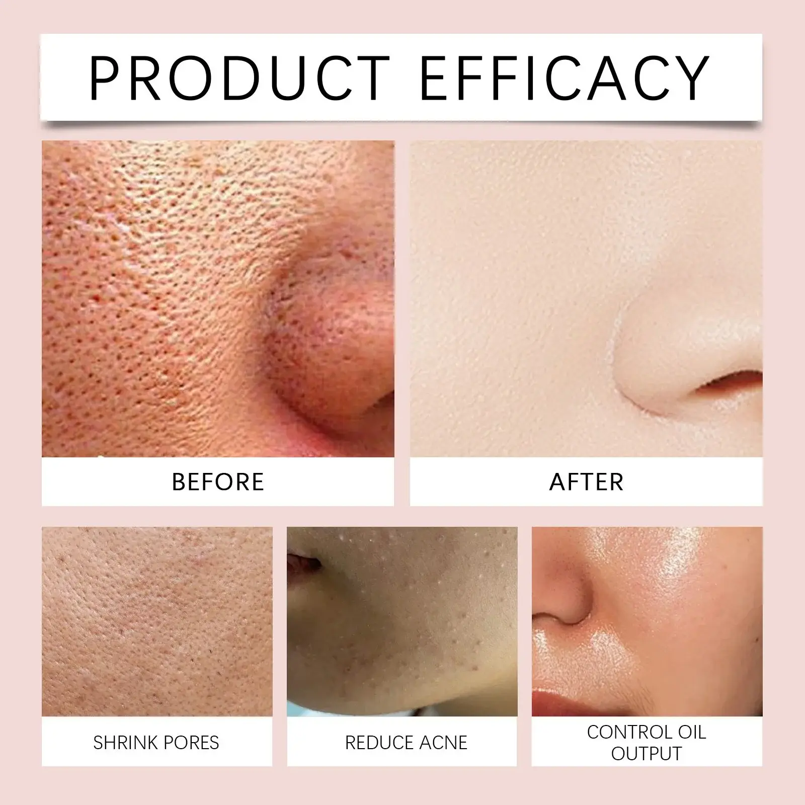 Gentle Exfoliating Gel for Face and Body - Hoygi 12 HO A05 1009 01 37301849