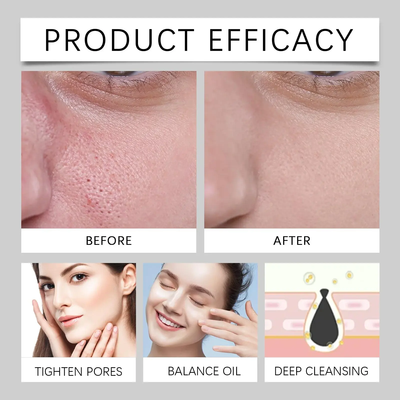 Firming Essence: Oil Balancing & Pore Refining - Hoygi 9 HO A05 1024 01 27159360