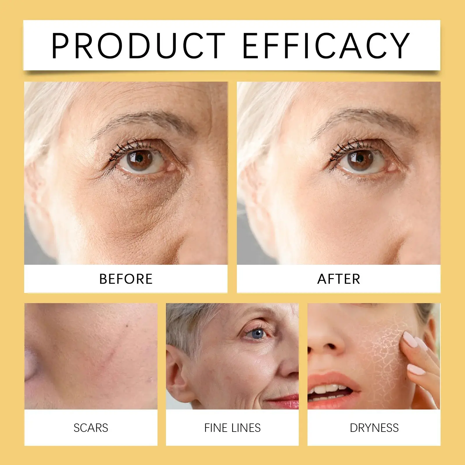 Bee Venom Skin Care Cream with Collagen & Peptides - Hoygi 10 HO A05 1031 01 92497521
