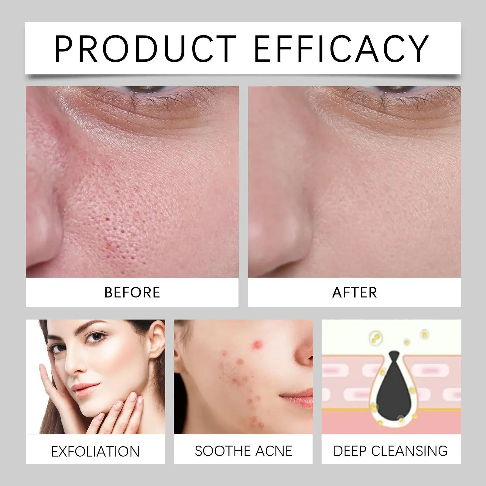 Salicylic Acid Toner Pads for Gentle Cleansing & Nourishing - Hoygi 12 HO A05 1041 01 39697071