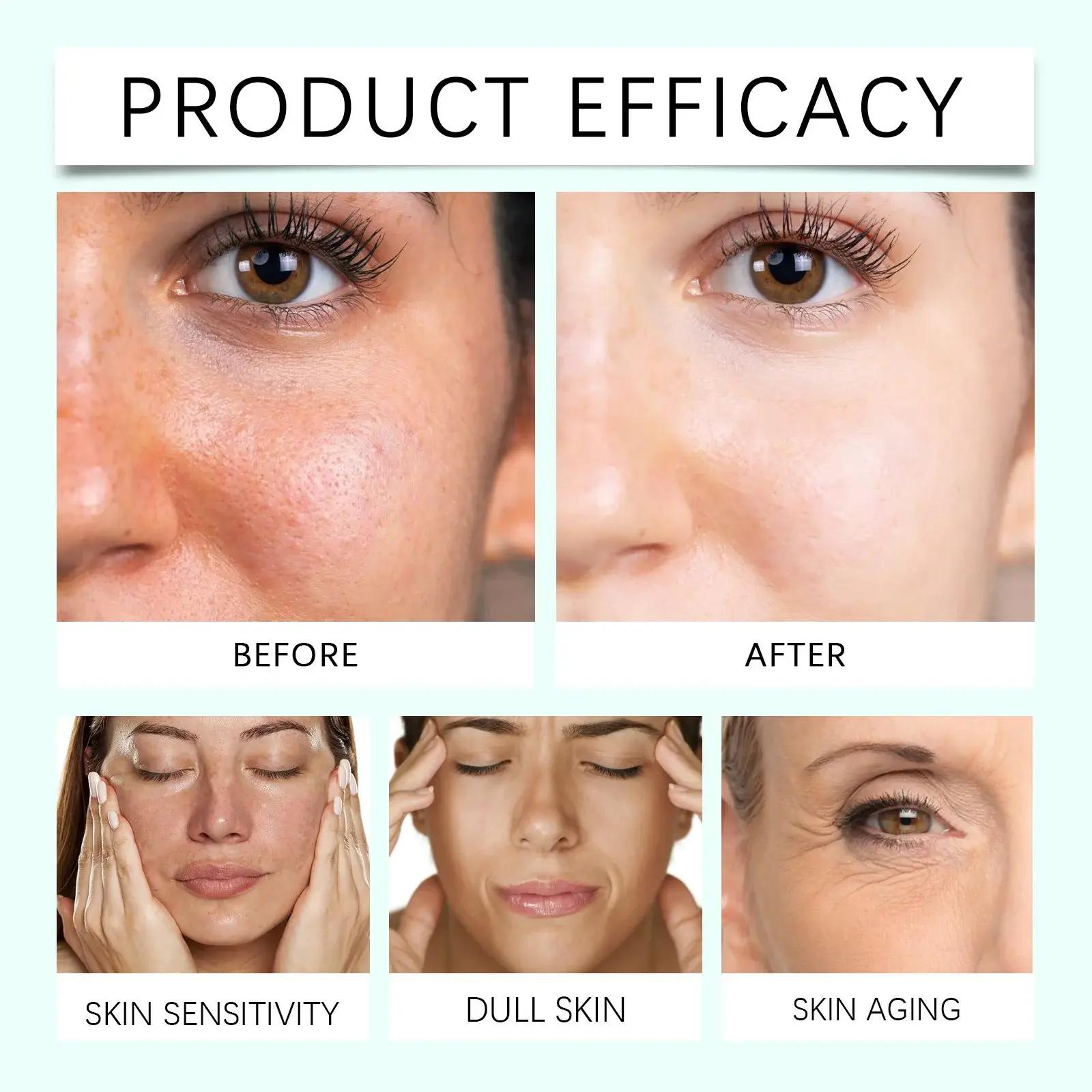 Nicotinamide Essence Skin Brightening & Moisturizing Serum - Hoygi 12 HO A05 1045 01 68132949