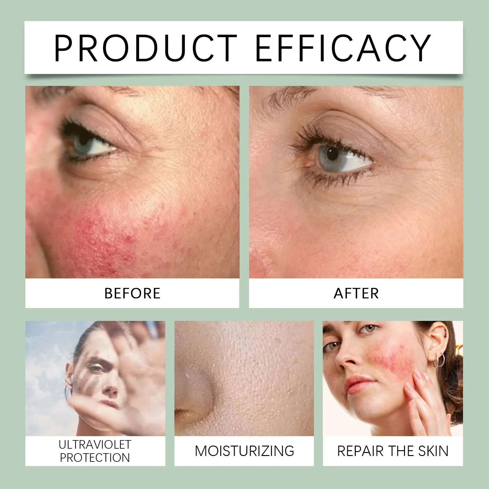 Centella Asiatica Protective Cream for Brightening and Hydration - Hoygi 9 HO A05 1056 01 72706687