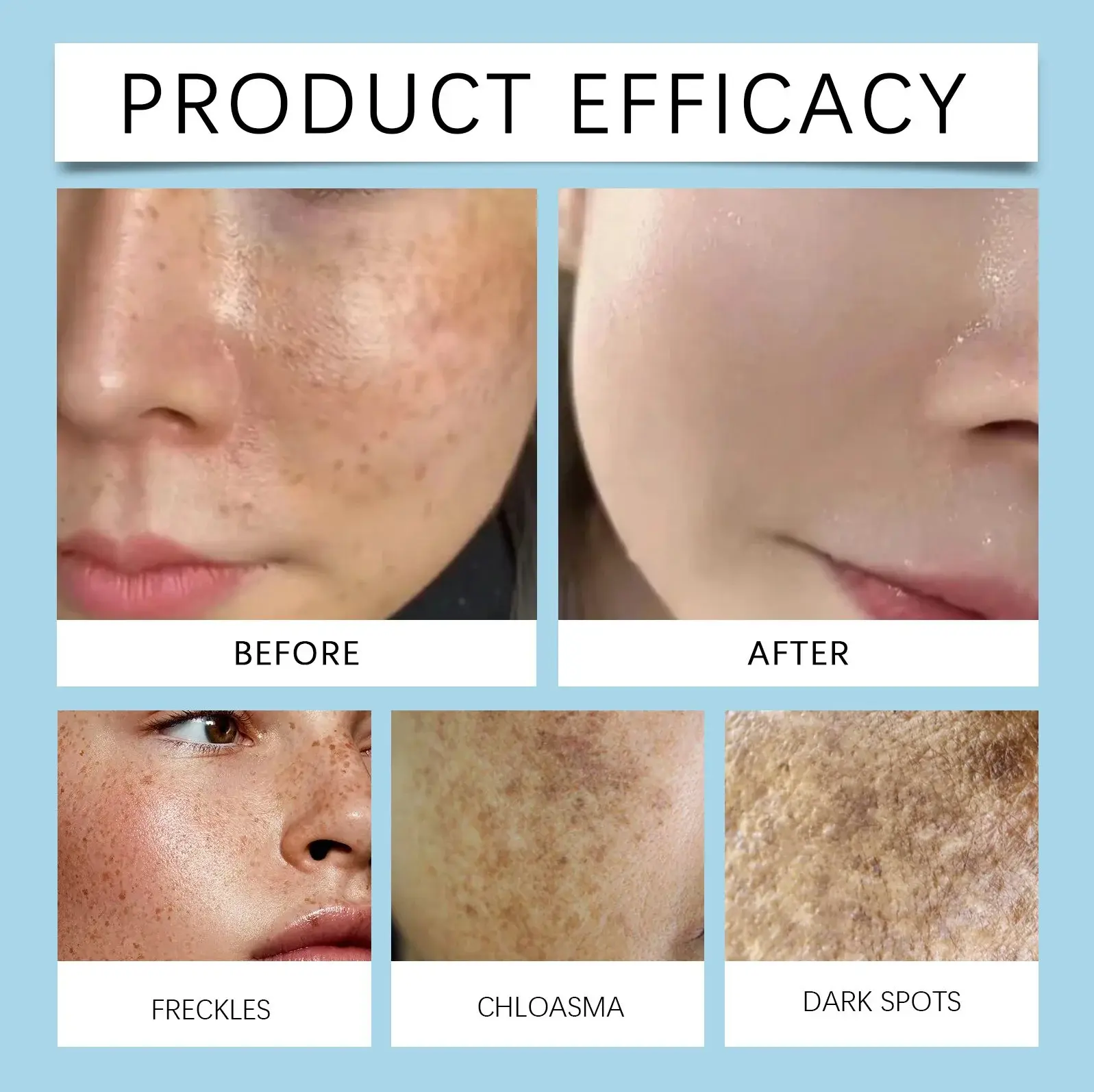 Hydrating Facial Care Essence with Kelp Extract & Salicylic Acid - Hoygi 9 HO A05 1061 01 94374741