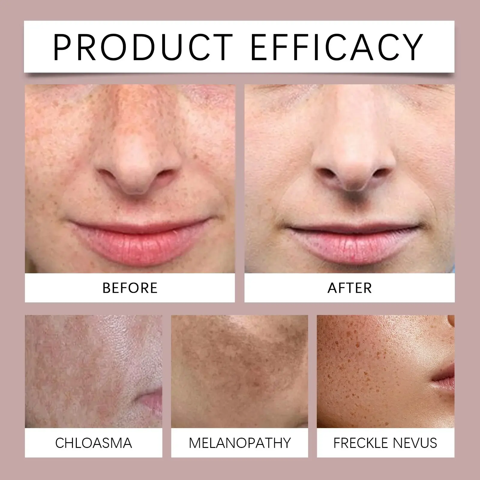 Brightening & Hydrating Facial Moisturizer with Aloe Vera & Vitamin E 8 HO A06 0060 01 1730856627019