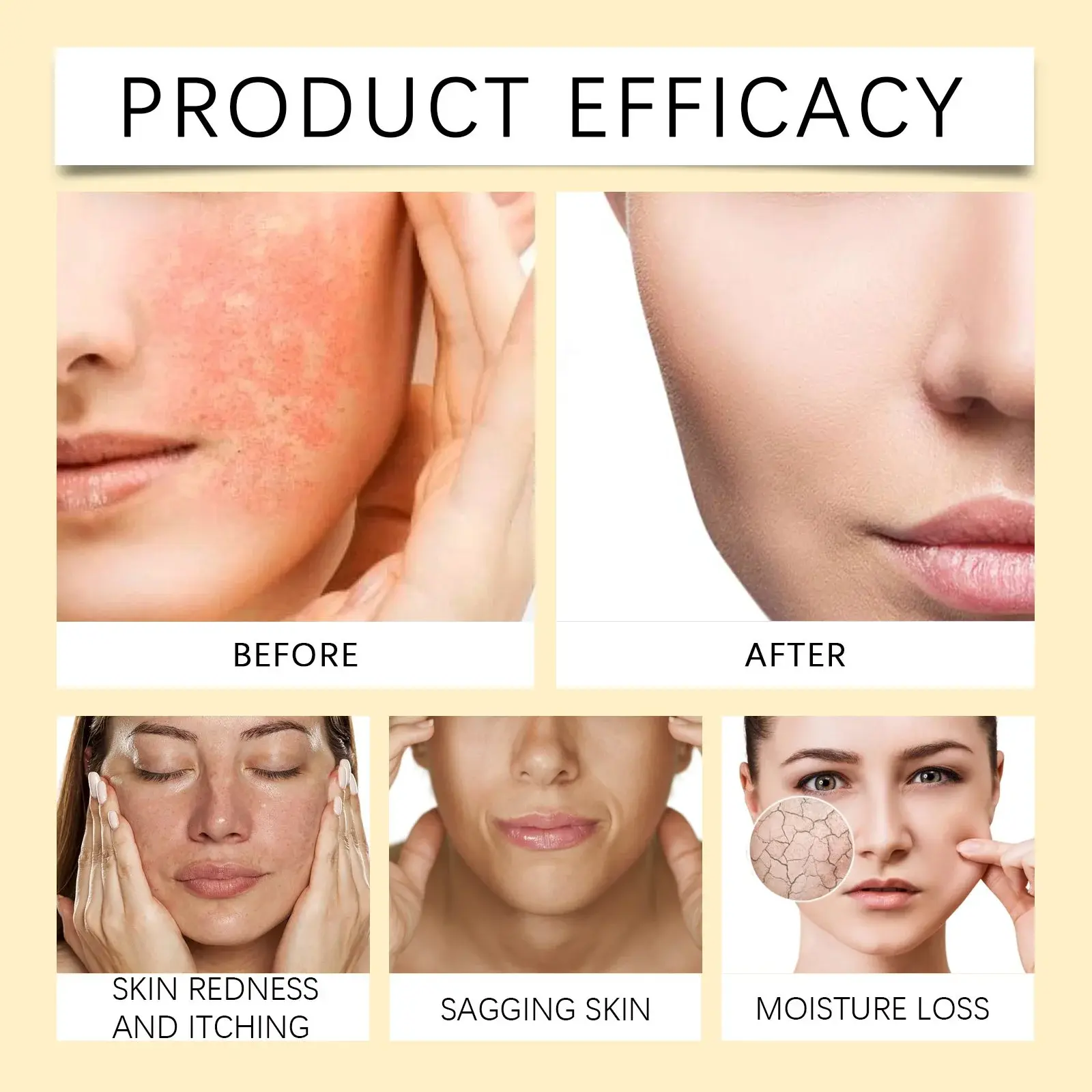 Moisturizing Cream for Dry Skin - Nourishing & Barrier Repair 9 HO A06 0085 01 1733882516022