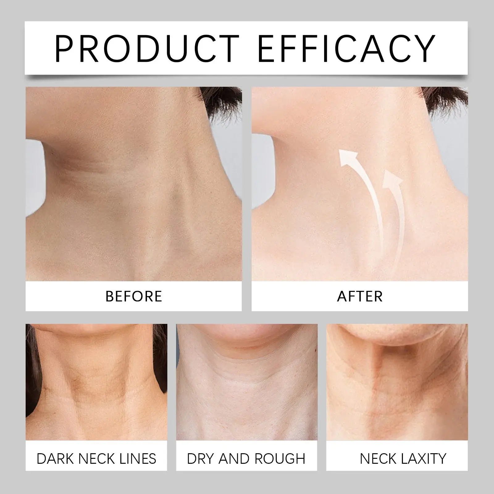 Neck Firming Roller Cream for Neck Lines and Fine Lines - Hoygi 12 HO A06 0112 01 53357005
