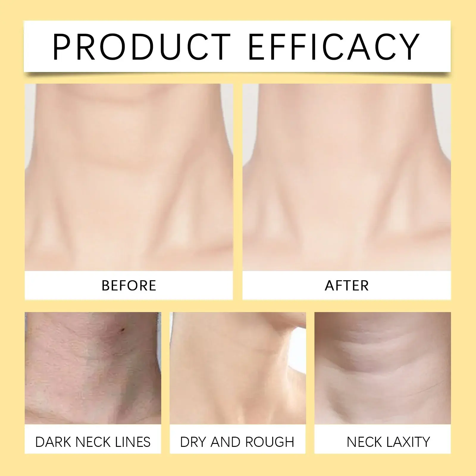 Neck Firming Cream Hydrating & Lifting Treatment - Hoygi 9 HO A06 0113 01 67387003