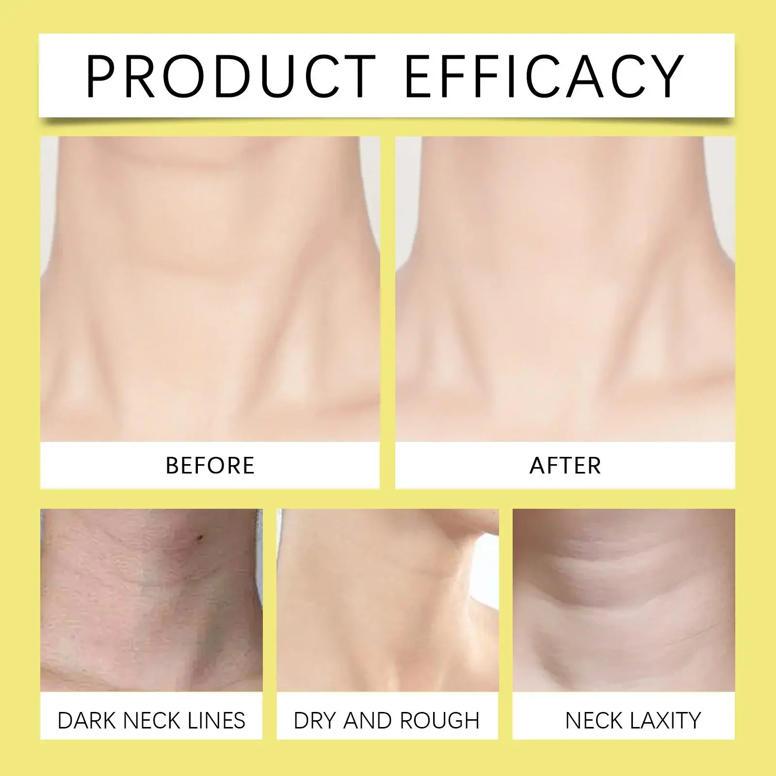 Neck Firming Cream for Skin Tightening and Line Reduction - Hoygi 12 HO A06 0115 01 60249092