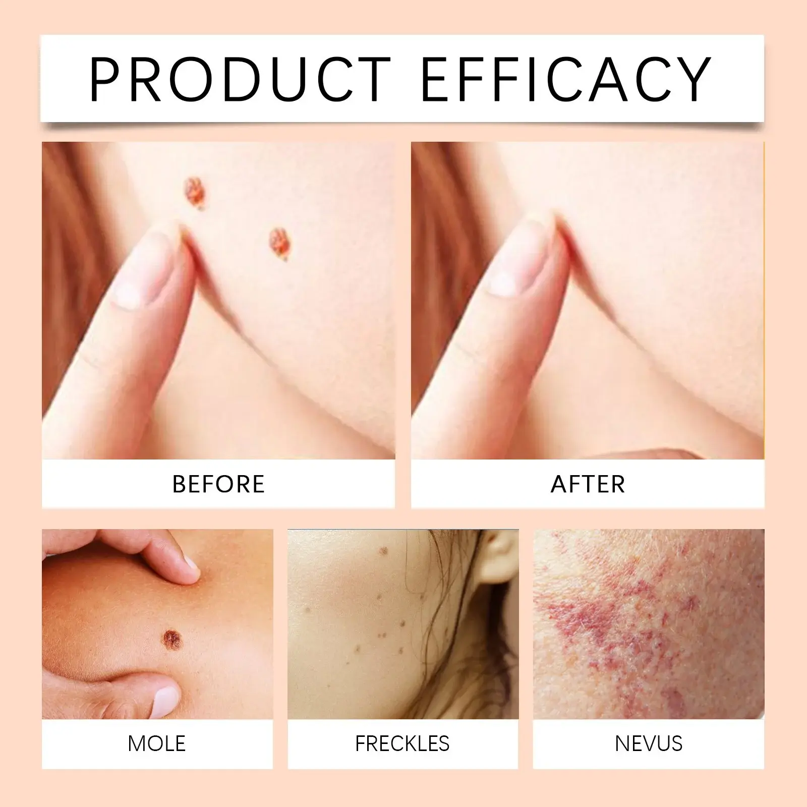 Bee Venom Keyu Essence for Moisturizing and Skin Repair 9 HO B07 0002 01 1725249654013