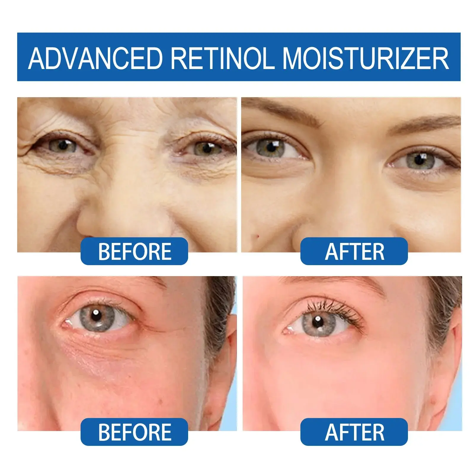 Anti-Aging Cream with Retinol - Reduces Fine Lines & Firms Skin 8 HOA02 A019 50 BU1 009