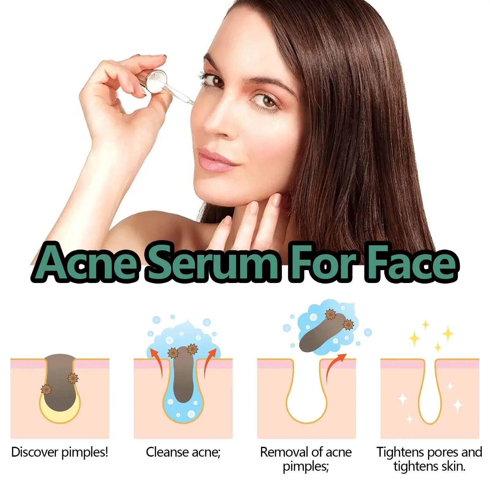 Acne Essence for Pore Care & Skin Brightening 5 HOA02 A039 30 WH1 14