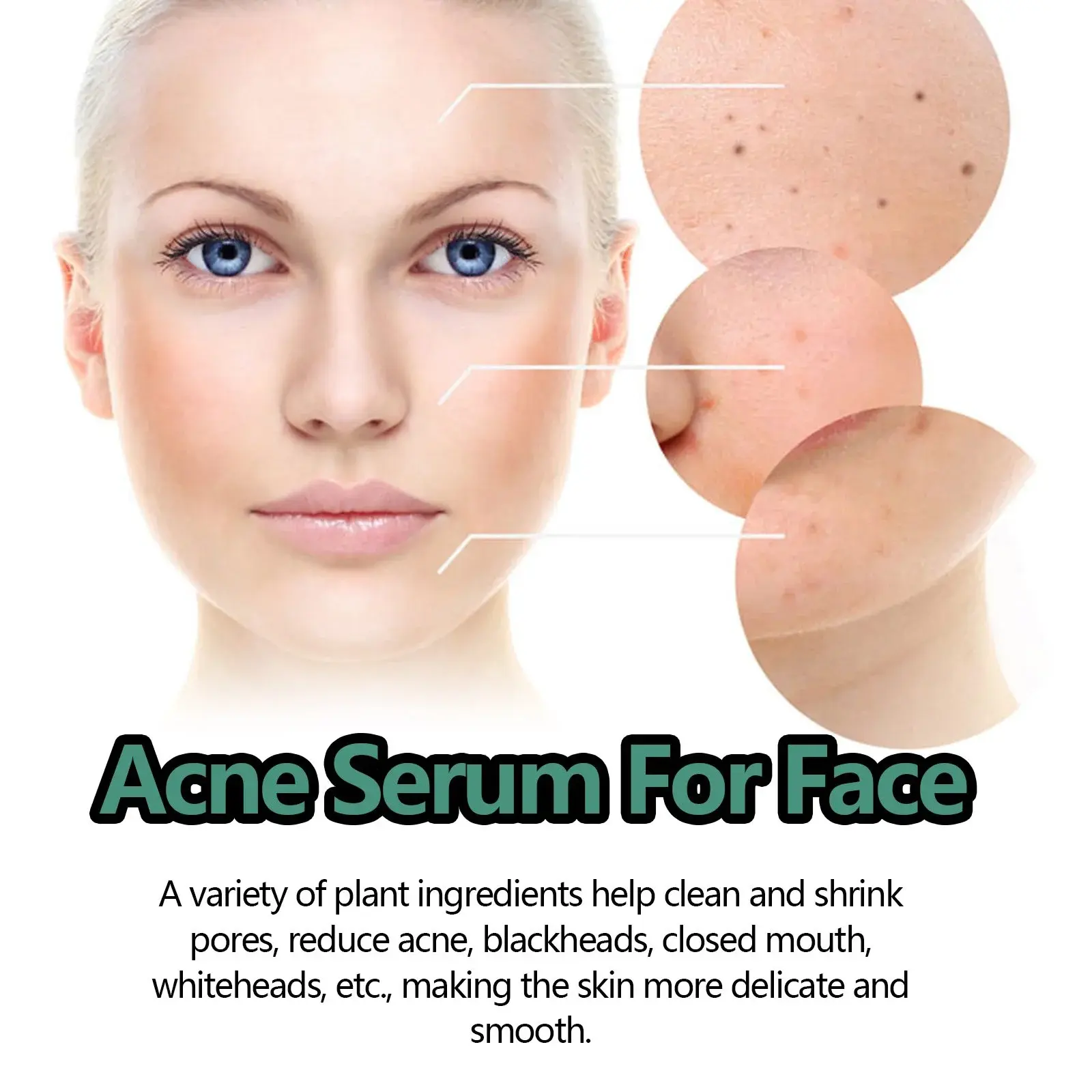 Acne Essence for Pore Care & Skin Brightening 6 HOA02 A039 30 WH1 15