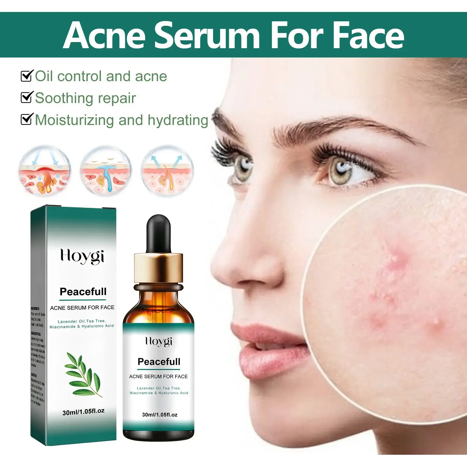 Acne Essence for Pore Care & Skin Brightening 7 HOA02 A039 30 WH1 16