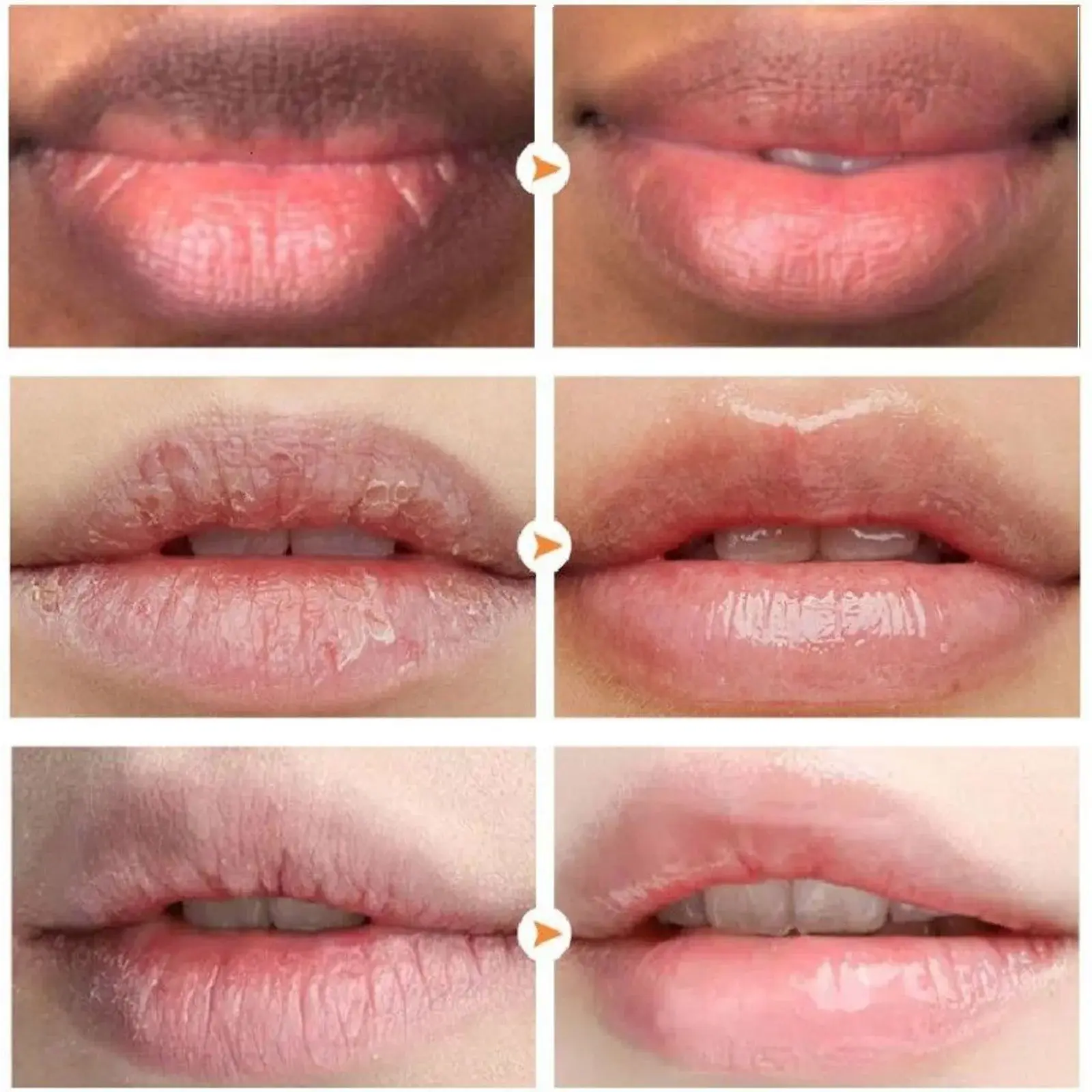 Double Effect Lip Balm Moisturizing & Exfoliating Treatment - Hoygi 10 HOA02 A046 9 PK1 1735203653012