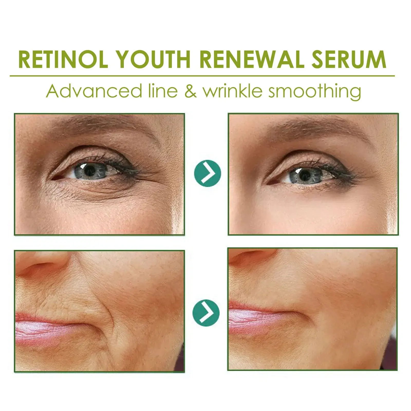 Retinol Essence - Moisturizing & Firming Skin Treatment 9 HOA02 A049 30 WH1 1017