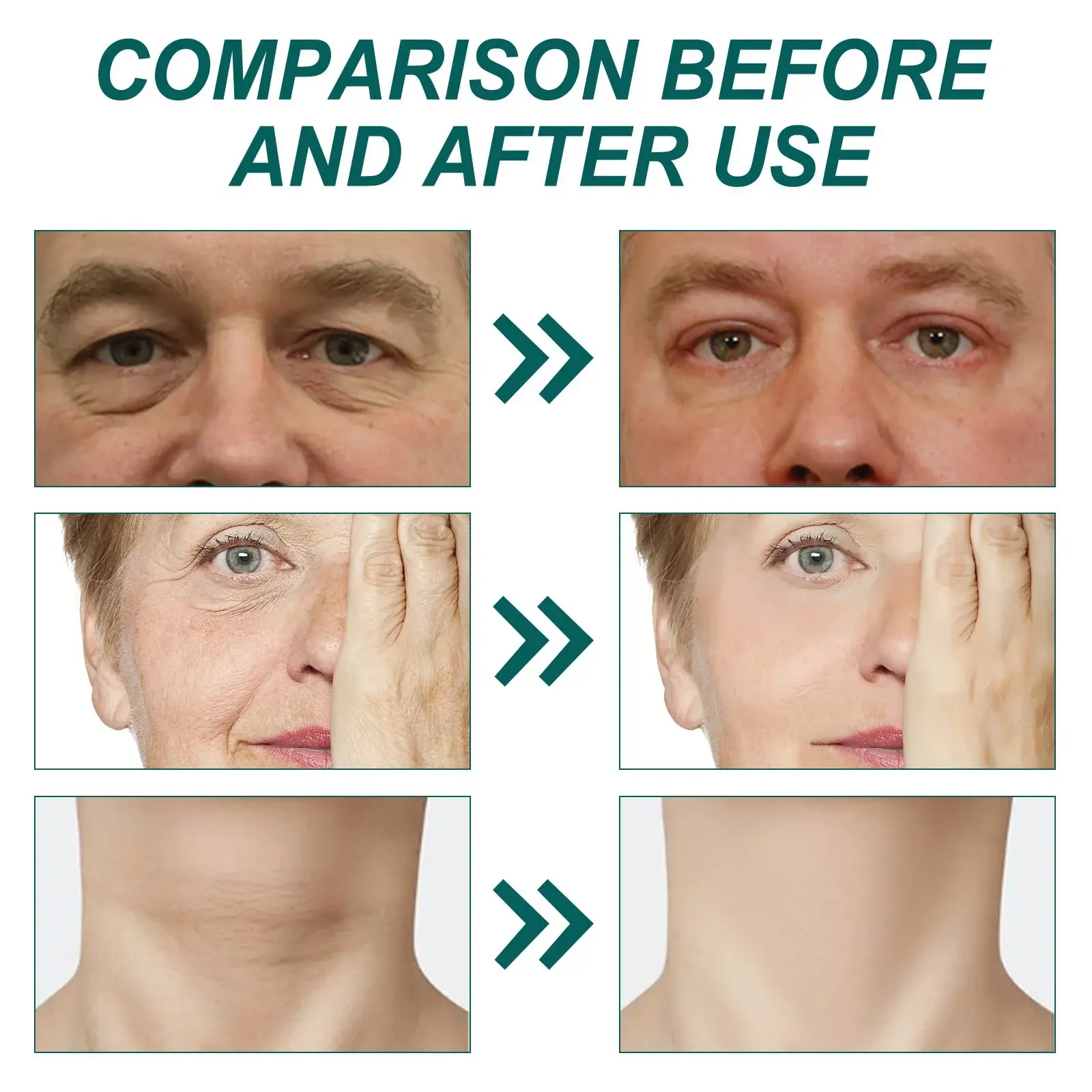 Collagen Retinol Moisturizer - Anti-Aging Face and Neck Cream 10 HOA02 A060 50 WH1 1017