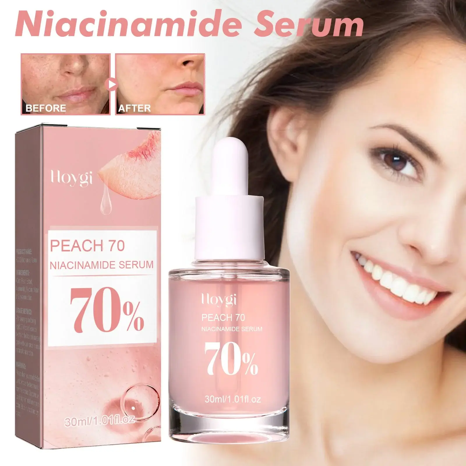 Nicotinamide Essence Pore Minimizer & Brightening Serum - Hoygi 2 HOA02 A077 30 PK1 003