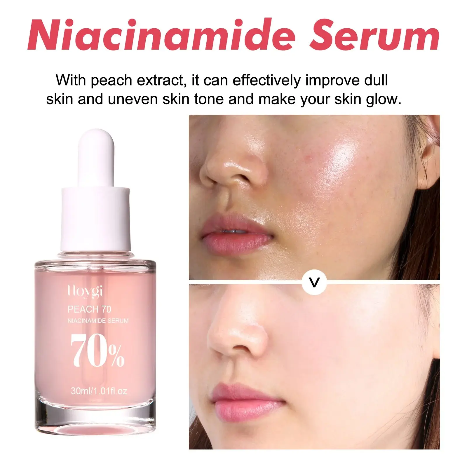 Nicotinamide Essence Pore Minimizer & Brightening Serum - Hoygi 6 HOA02 A077 30 PK1 007