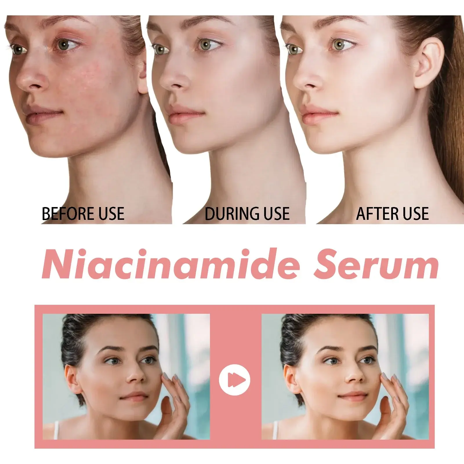 Nicotinamide Essence Pore Minimizer & Brightening Serum - Hoygi 8 HOA02 A077 30 PK1 009
