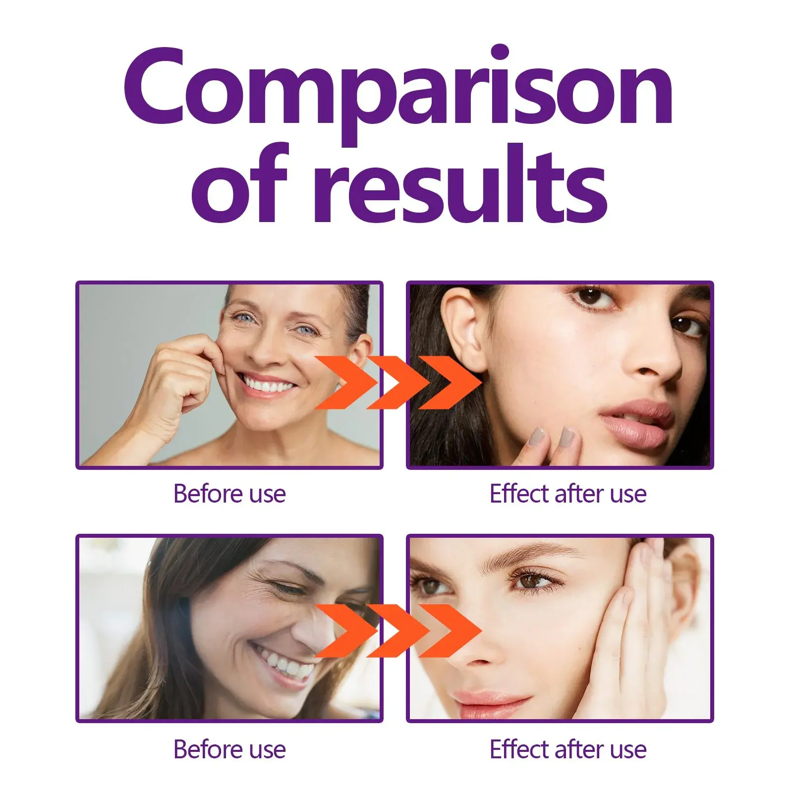 Face Lift Cream - Anti-Wrinkle & Firming Formula - Hoygi 9 HOA02 A080 30 WH1 1730431811015