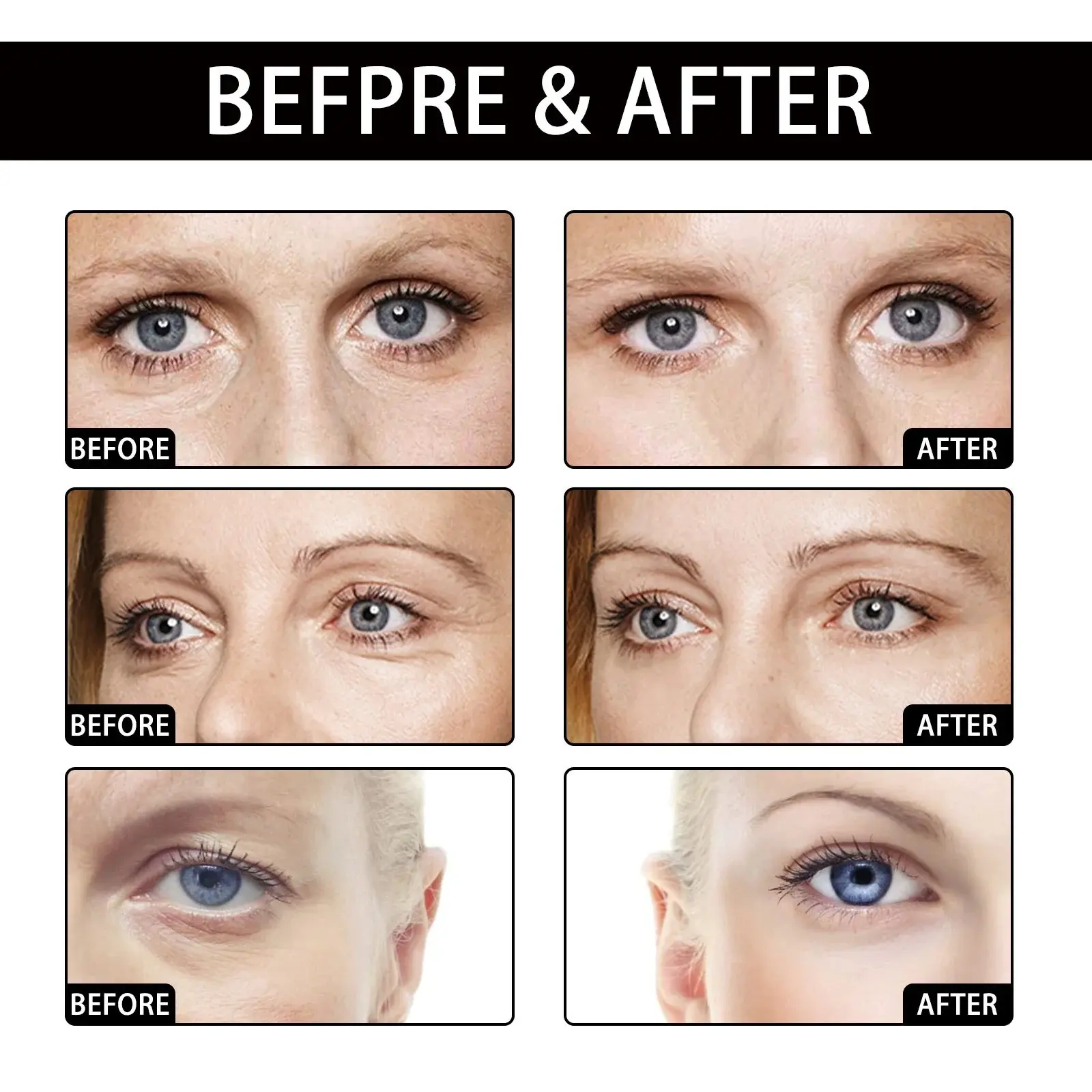 Aloe Vera Eye Gel Patch for Fine Lines & Dark Circles 9 HOA02 A084 10 GN3 010