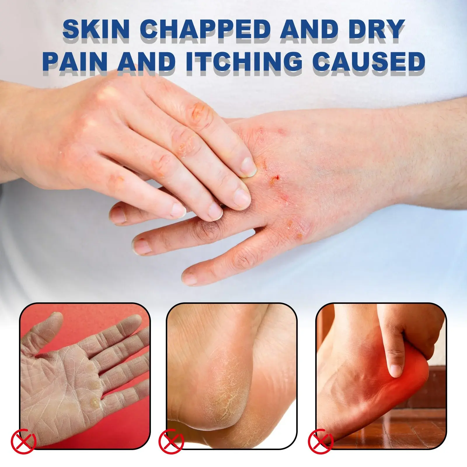 Hand and Foot Care Stick - Anti-Cracking Moisturizer with Shea Butter 5 HOA03 A006 40 WH1 006