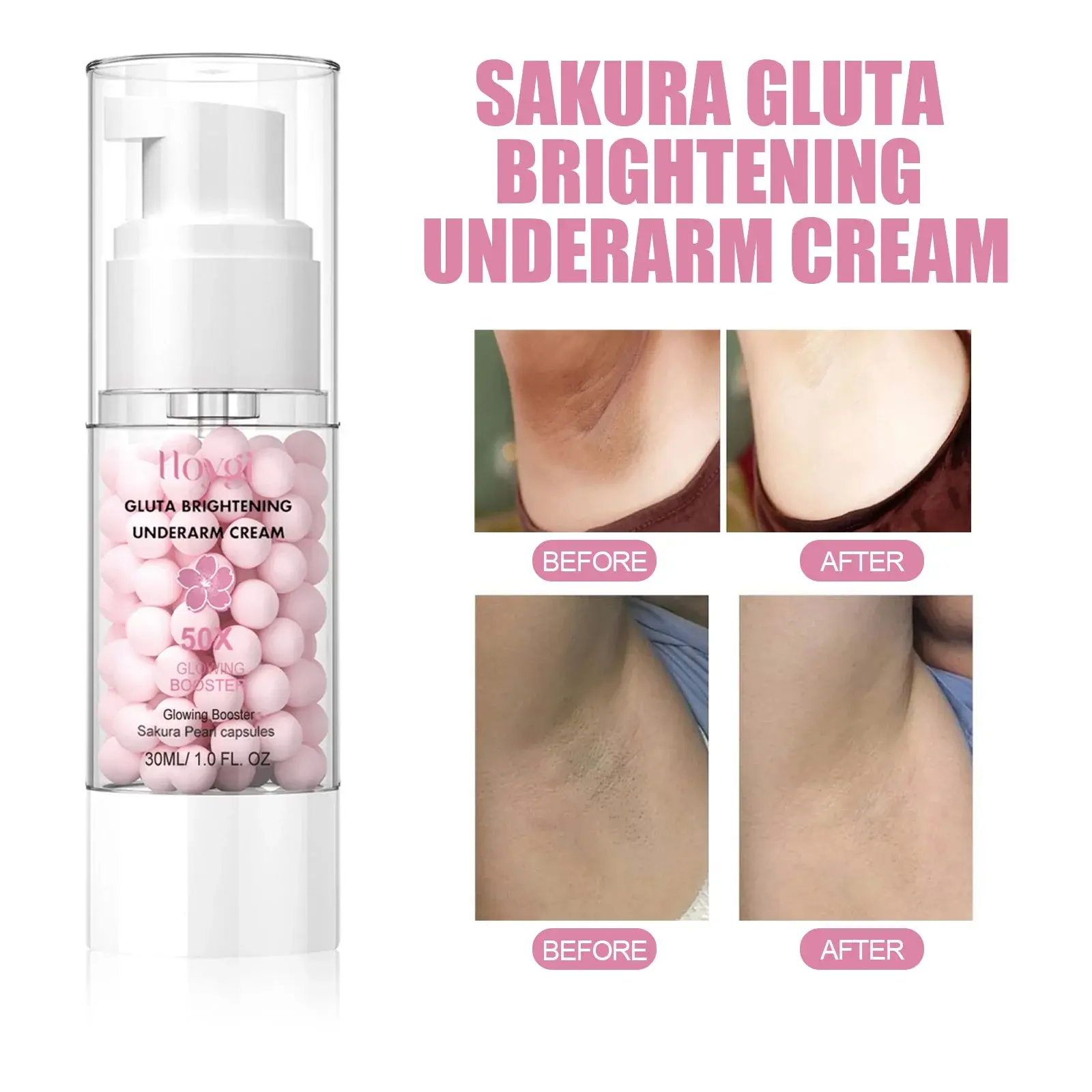 Skin Brightening Cream for Underarms & Elbows - Hoygi 9 HOA03 A008 30 WH1 010
