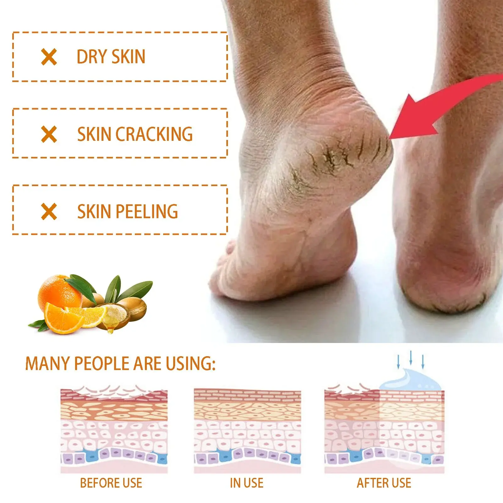 Hand and Foot Cream for Cracked Skin Repair & Moisturizing 8 HOA03 A012 40 WH1 1013