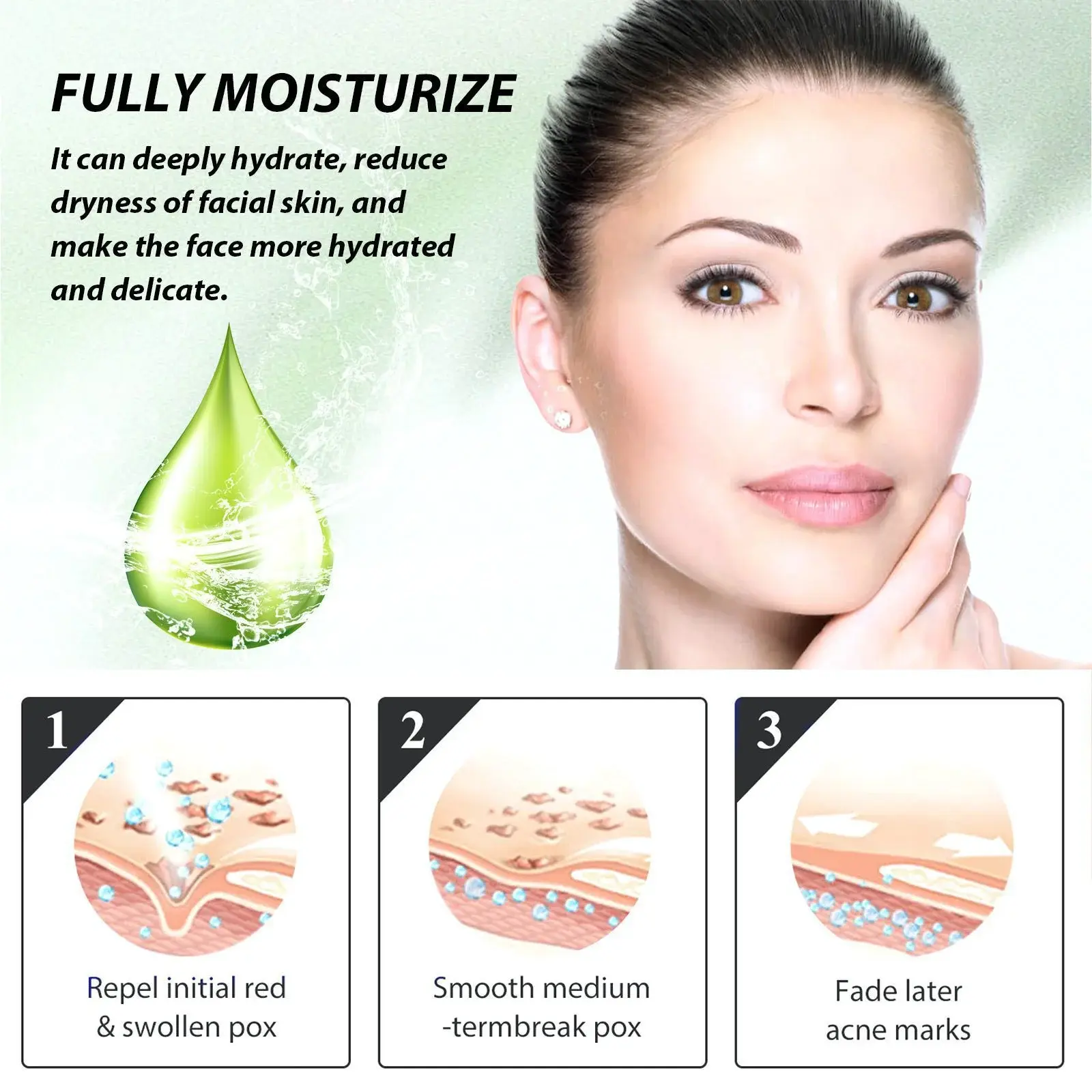 Herbal Acne Serum - Pore Cleansing & Skin Hydration 6 HOA05 A011 30 GN1 006