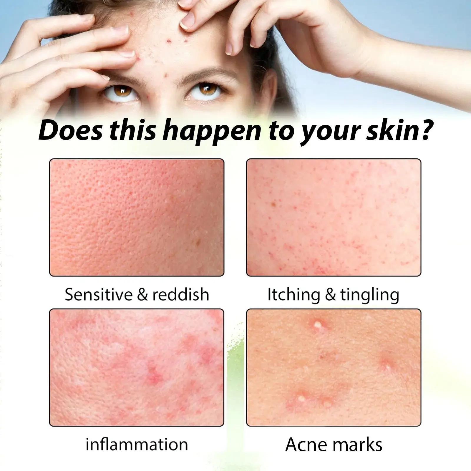 Herbal Acne Serum - Pore Cleansing & Skin Hydration 7 HOA05 A011 30 GN1 007
