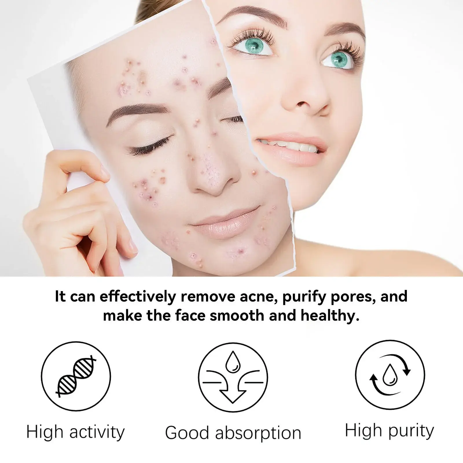Herbal Acne Serum - Pore Cleansing & Skin Hydration 8 HOA05 A011 30 GN1 008
